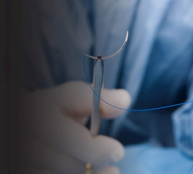 I migliori fili di sutura